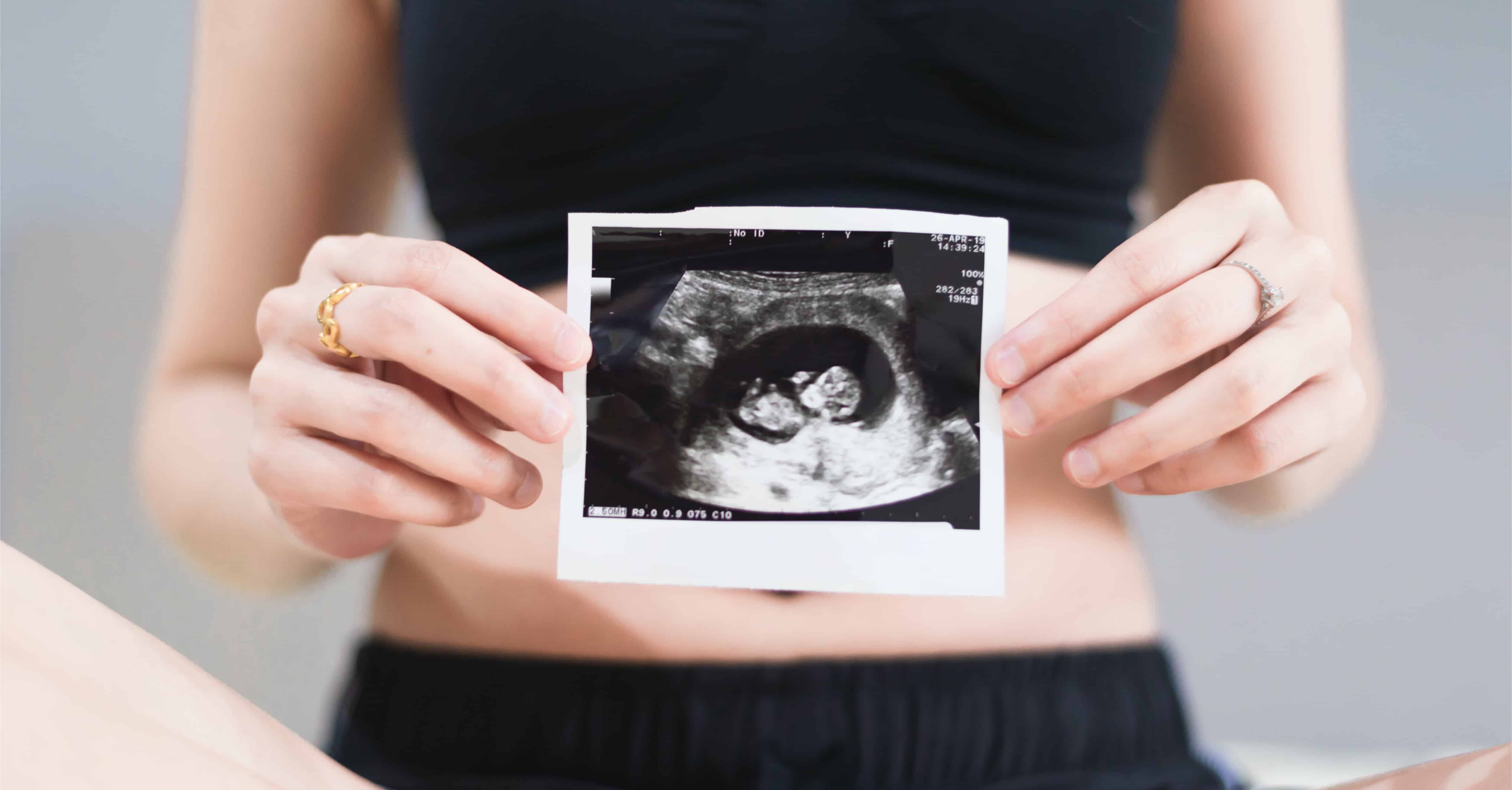 12 недель беременности что есть. Снимки УЗИ. УЗИ беременной.